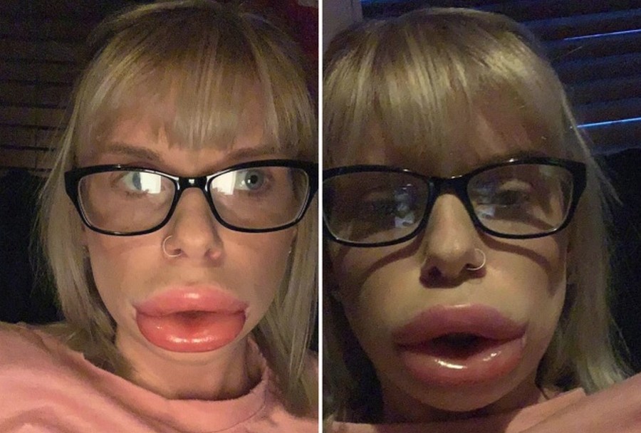 Техника татуажа lip kiss: эффект зацелованных губ - pro.bhub.com.ua